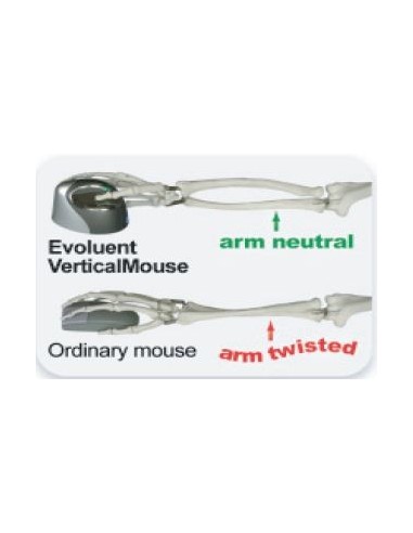 avantage position bras souris verticale